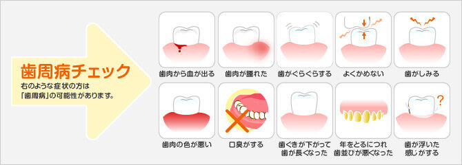 歯周病チェック