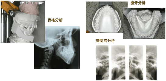 骨格分析 歯牙分析 股関節分析